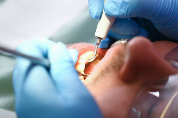 Best Broken or Cracked Tooth Emergency Dentist in Arlington, TN