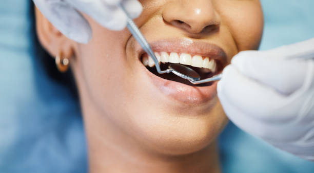 Best Emergency Dental Care for Abscessed Tooth in Arlington, TN