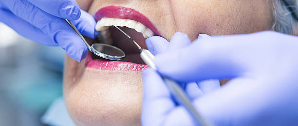 Best Emergency Root Canal Treatment in Arlington, TN